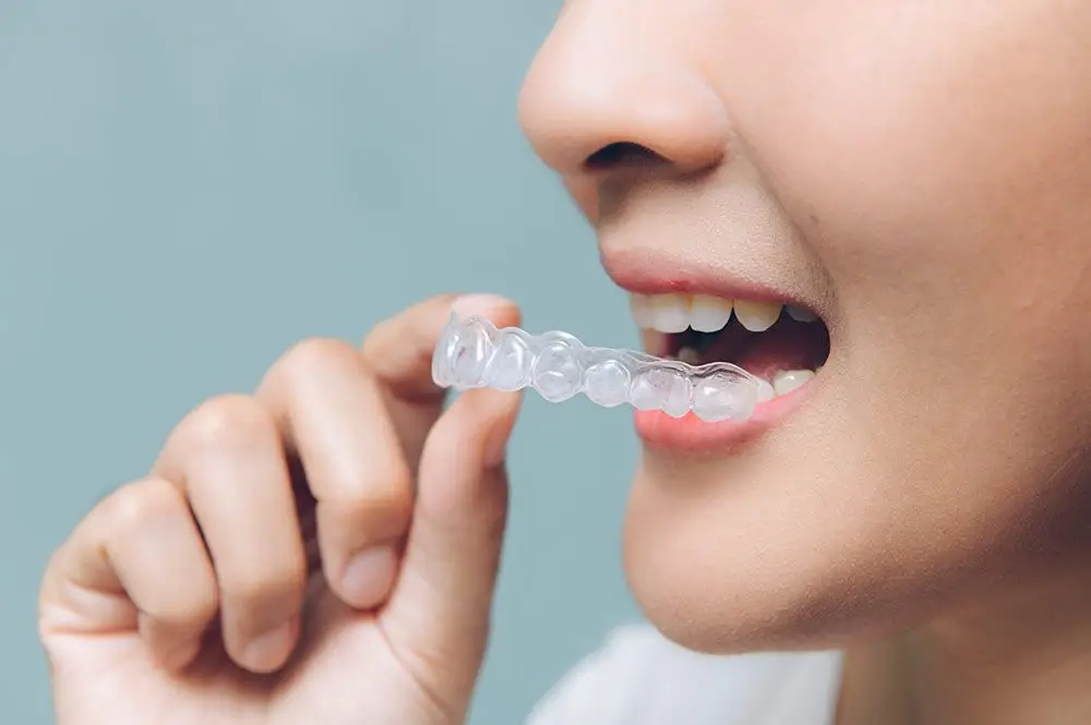 Invisalign Treatment Plan For You