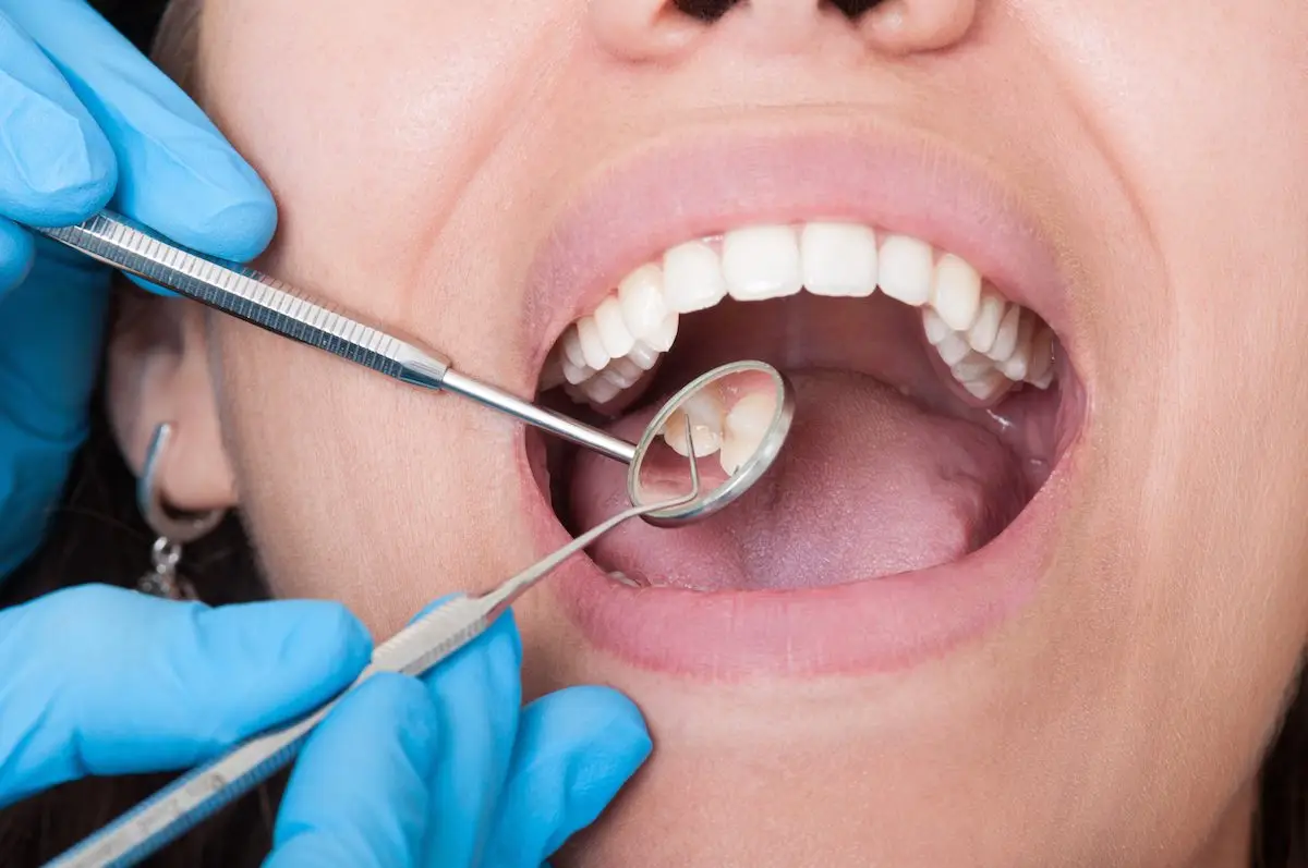 Why and How to Choose General Dentistry for Oral Health? (A Complete Guide)
