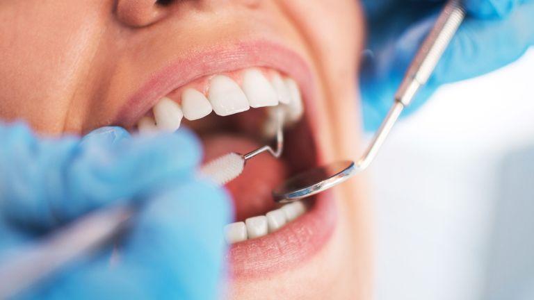 Find General Dentistry Practice At Schaumburg Dentistry