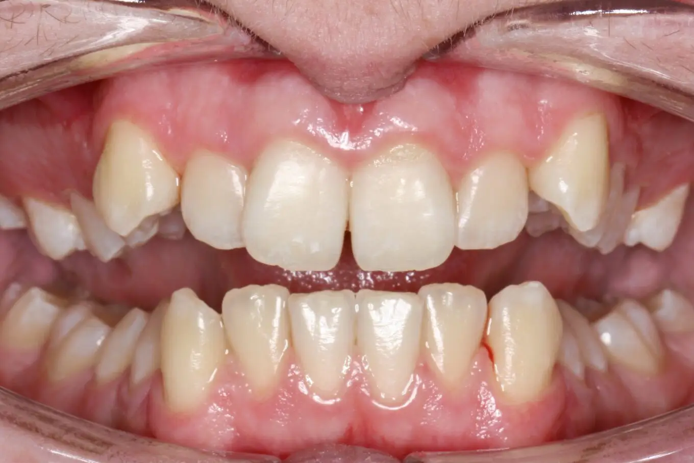 Teeth