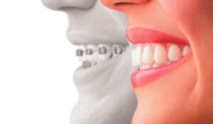 Smile With Confidence: A Guide To Cosmetic Dentistry
