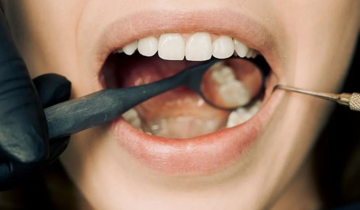 an up-close view of a dental mirror in the person's mouth