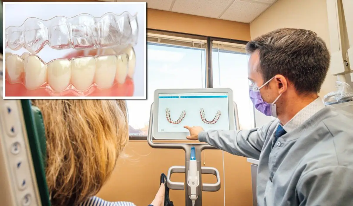 An Invisalign aligner attached to teeth and a doctor explaining about the aligners..