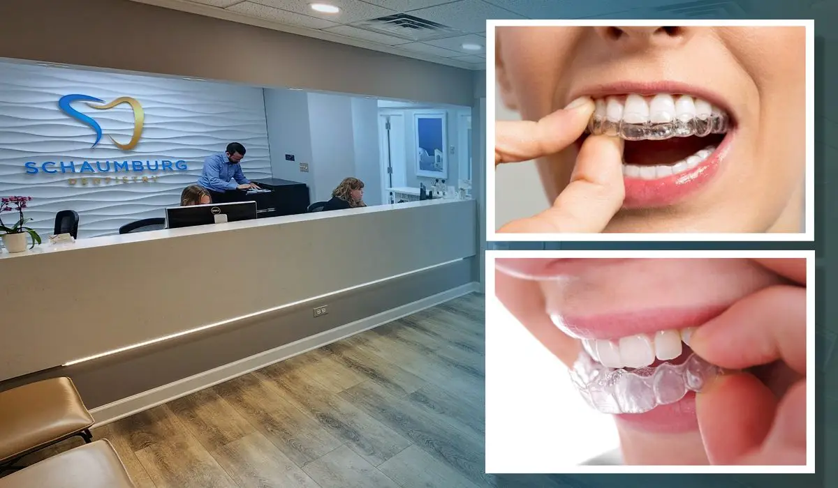 Women putting on Invisalign braces. Local clinic of Schaumburg Dentistry.