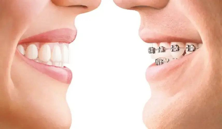 Invisalign vs. Traditional Braces: What Schaumburg Residents Should Know