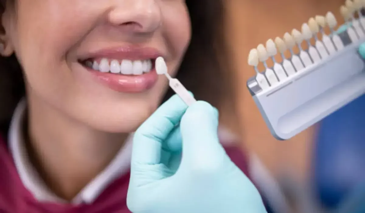 Dental professional matching veneer shade to patient’s teeth, highlighting protection against damage and enamel preservation.