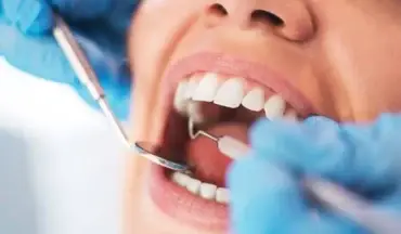 Dental checkup in progress showing the link between oral health and heart disease prevention.