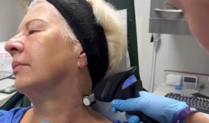 A woman receives Opus Plasma Skin Resurfacing treatment on her neck, suitable for sensitive aging skin types.