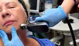 Woman receiving Opus Plasma skin treatment on face to reduce wrinkles and tighten skin non-surgically.